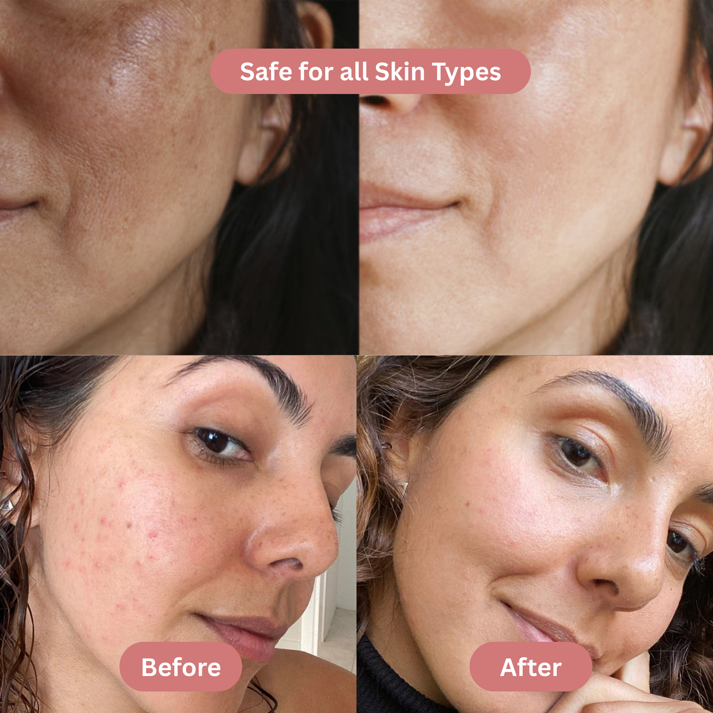 BerryLush Collagen Wrapping Mask – Imported from Korea